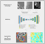 A deep learning-based segmentation pipeline for profiling cellular morphodynamics using multiple types of live cell microscopy